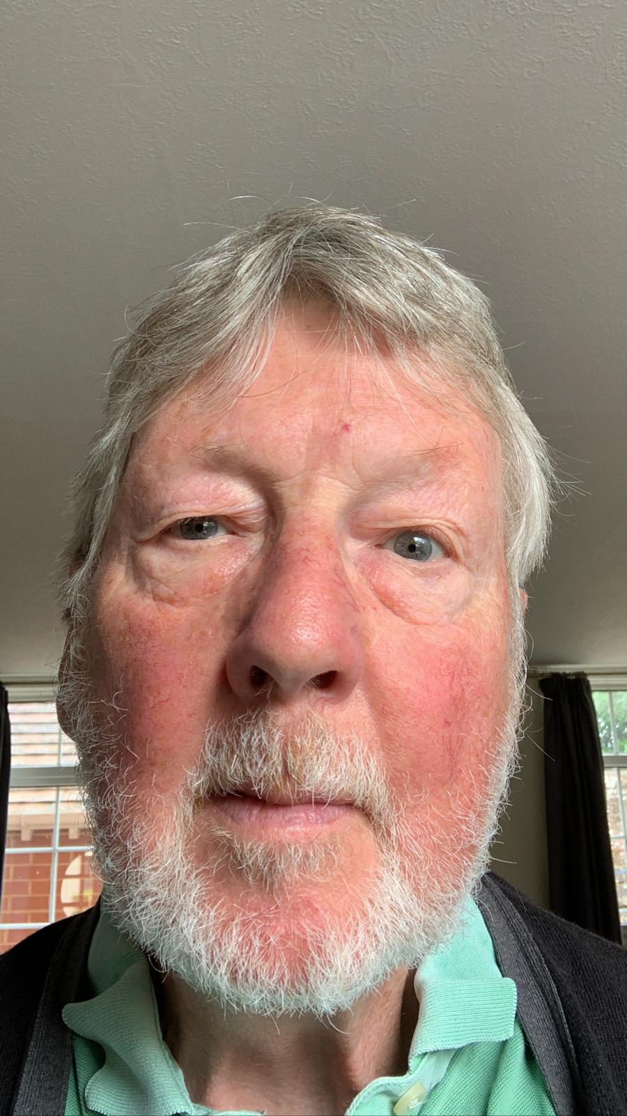 Martin P - Live-in Carer in Penryn